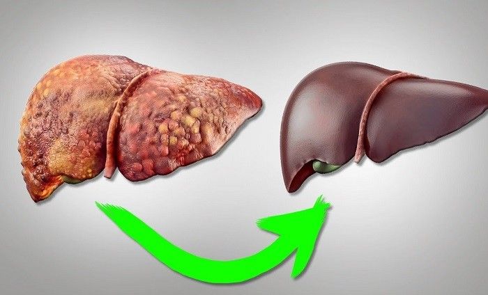 Главный враг печени, о котором вы не знали: угроза в 100 раз мощнее алкоголя