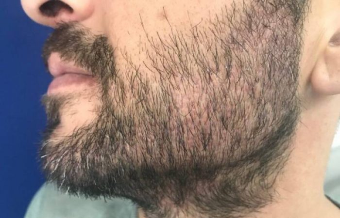 Международный день бороды и другие праздники, которые отмечают 5 сентября 2025 года