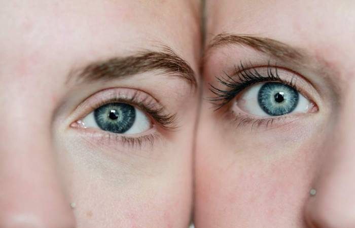 Почему у мужчин появляются под глазами темные круги: причины, возможные болезни, как бороться