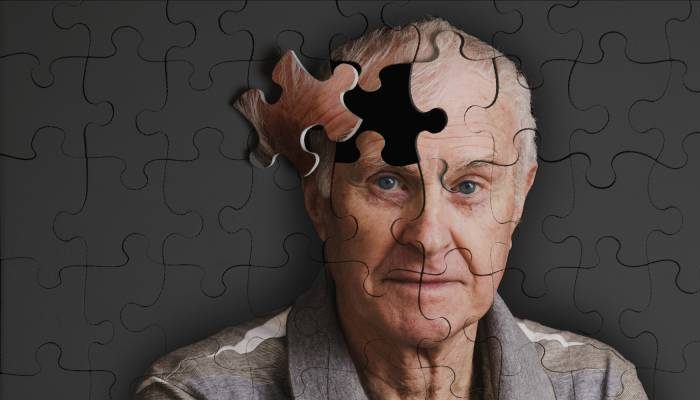 Какие существует методы лечения болезни Альцгеймера