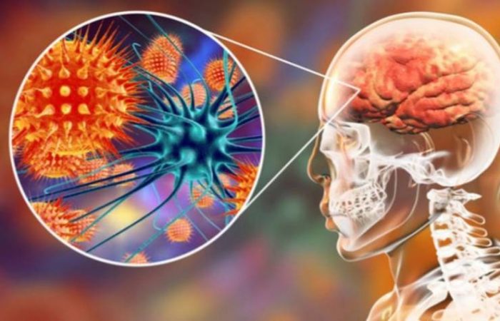 Ситуация с менингококковой инфекцией в России ухудшается: какой симптом может спасти жизнь