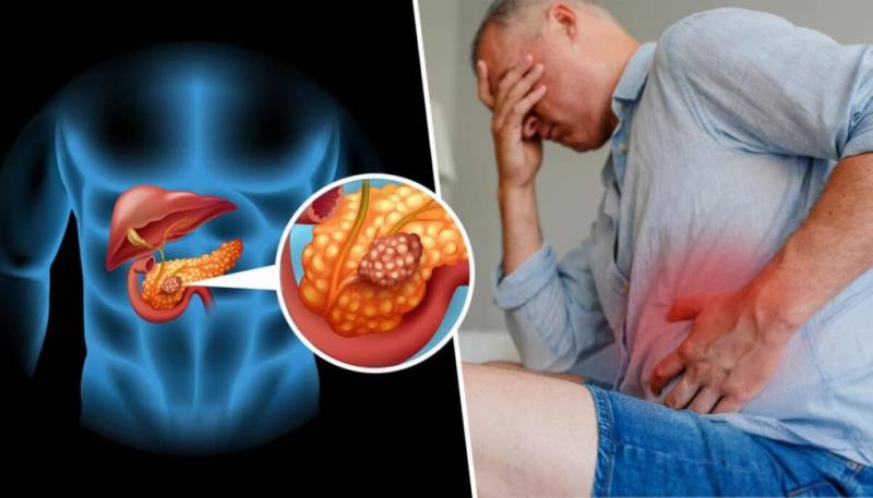 рак поджелудочной